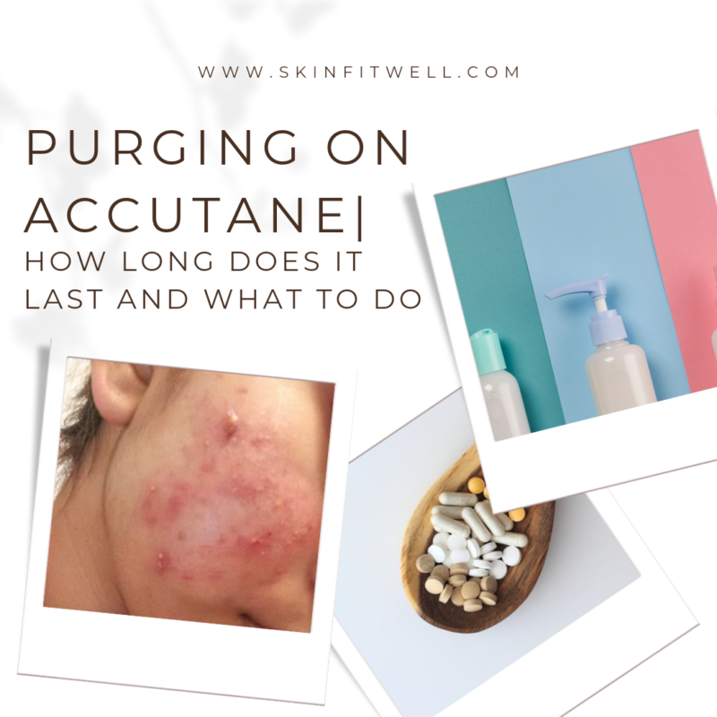 How Long Does Purging Last On Accutane? Skin Fit Well Skin Fit Well
