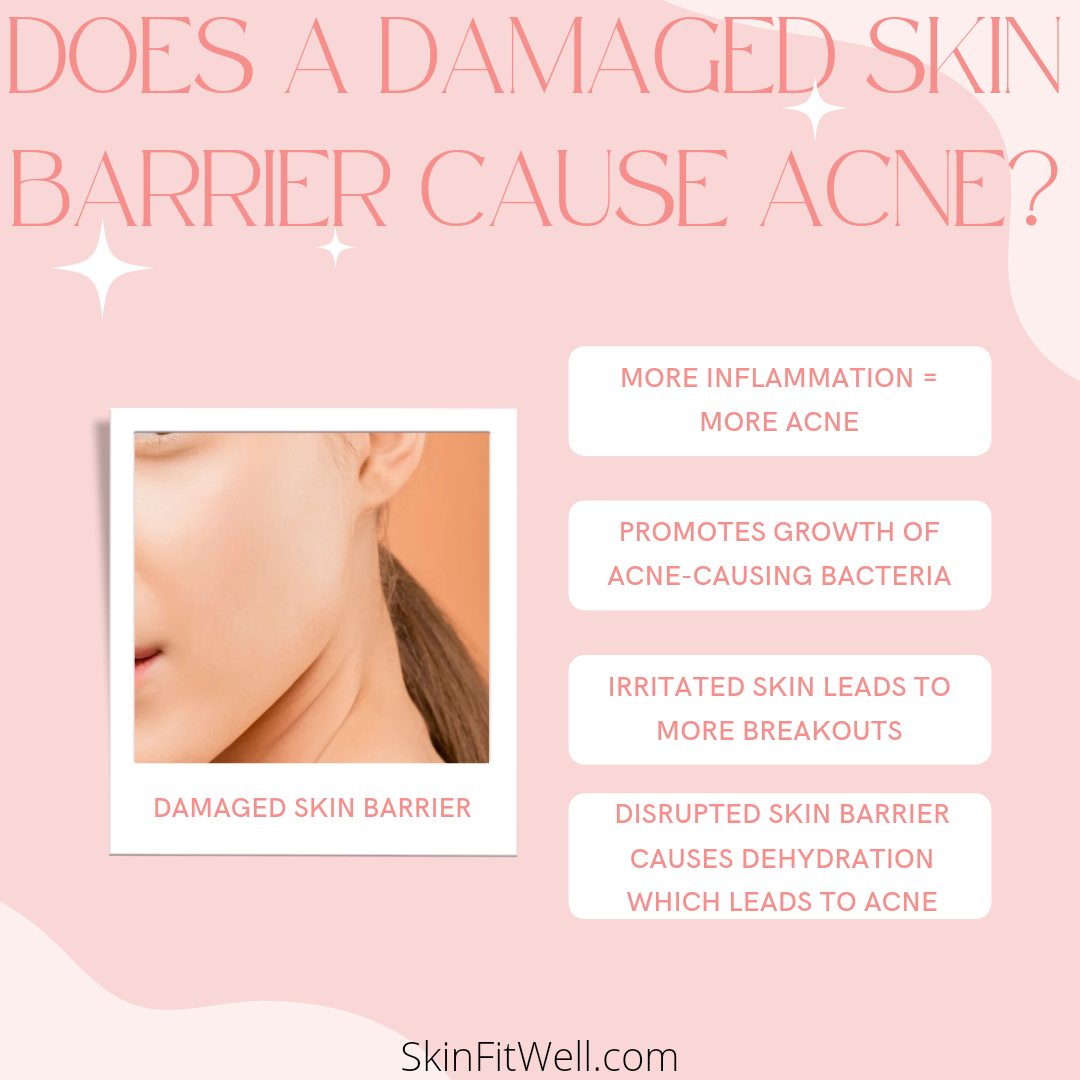 Does a Damaged Skin Barrier Cause Acne? (4 Ways To Fix It) | Skin Fit Well