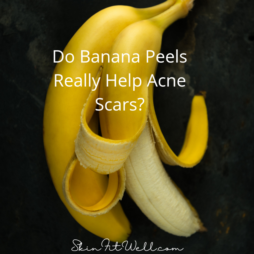 Do Banana Peels Really Help Acne Scars? Skin Fit Well